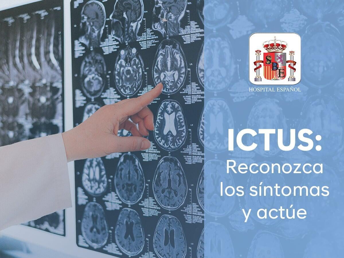 "ICTUS: Reconozca los síntomas y actúe"