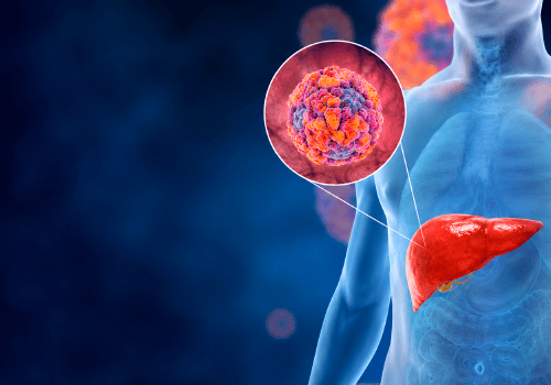 ¿Qué es la hepatitis y cómo prevenirla?